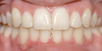 after-img.jpg after-img.jpg