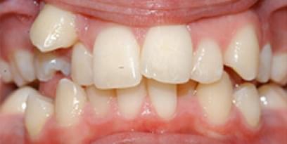 after-img.jpg after-img.jpg