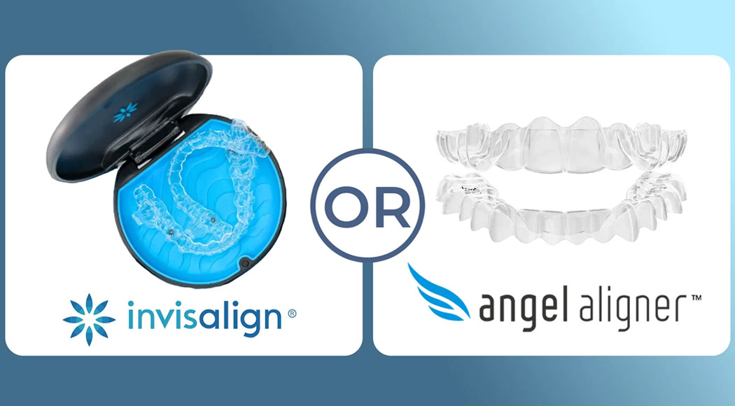 Angel Aligners vs Invisalign®: Which Clear Aligner Is Best For Your Smile?