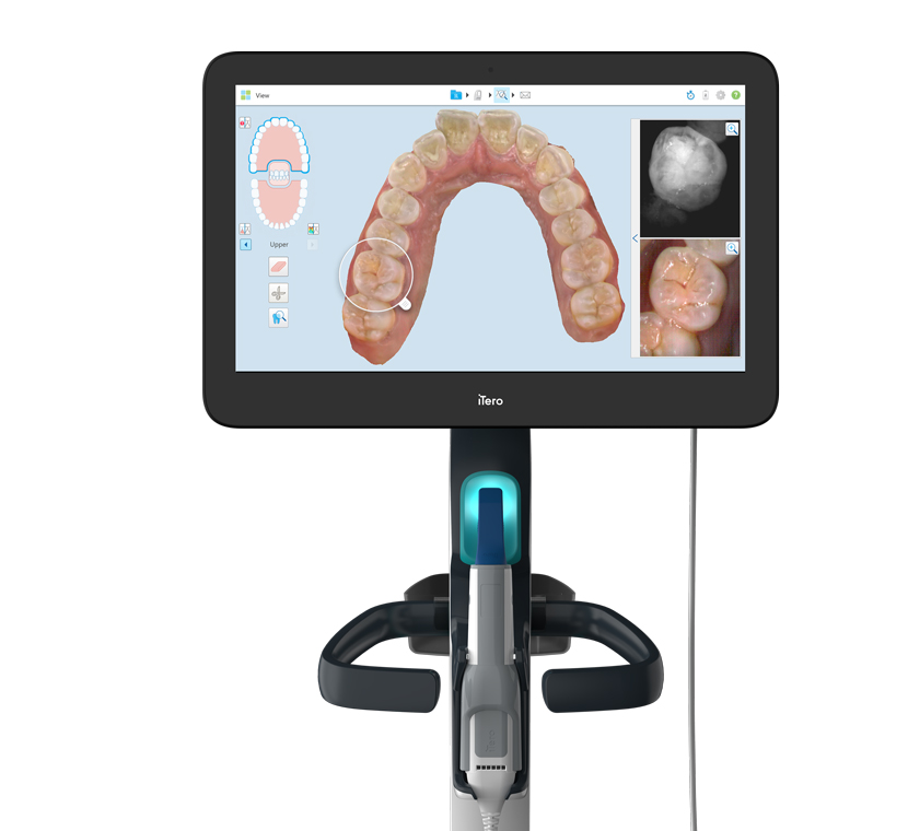 Digital revolutions: the
iTero Element Intraoral Scanner