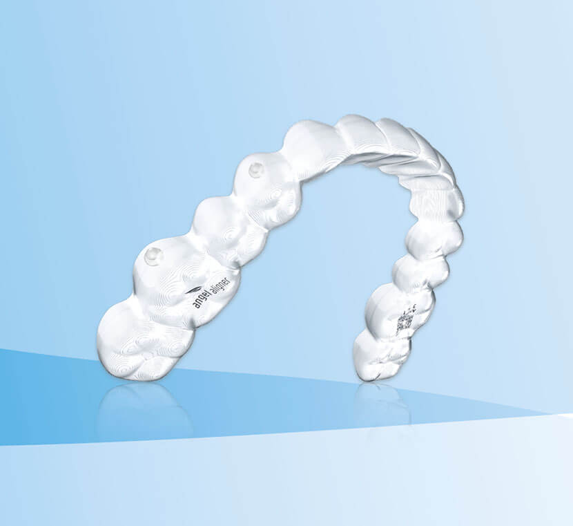 What are Angel Aligners?