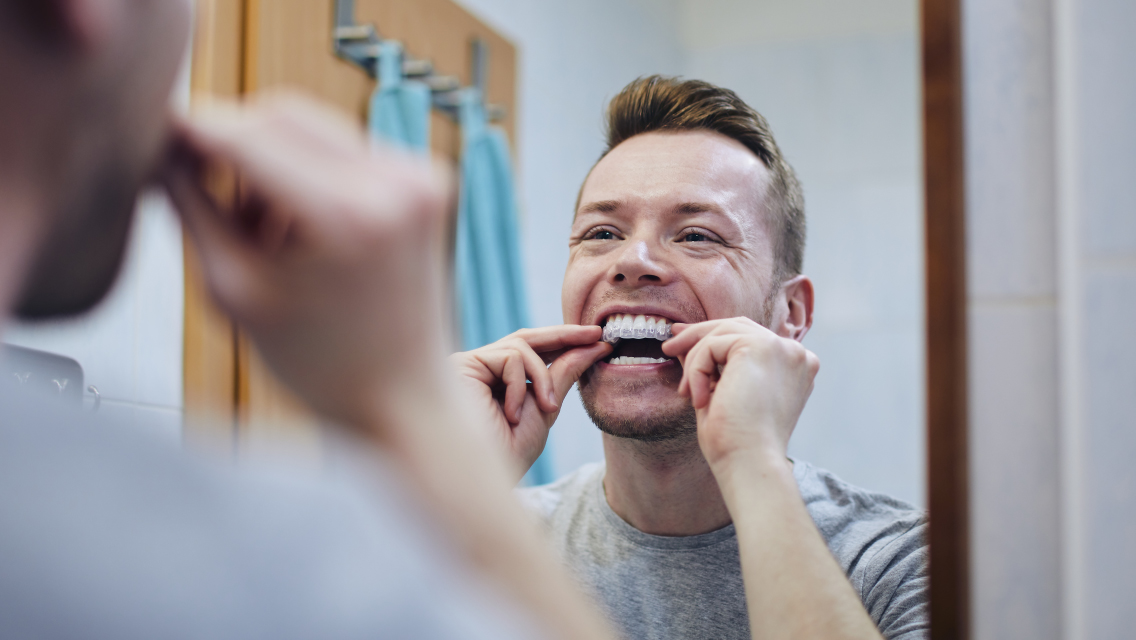 Clear aligners - the secret smile enhancers Clear aligners - the secret smile enhancers